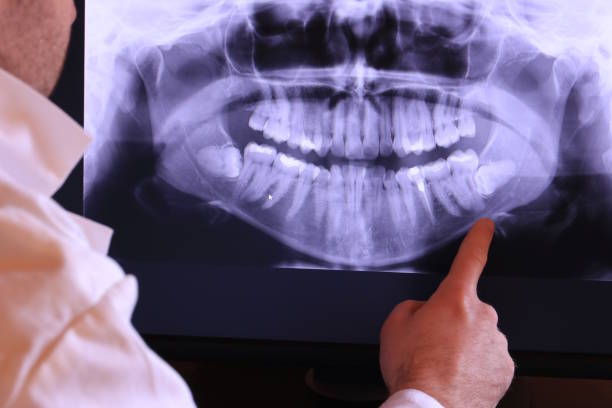 Best Emergency Root Canal Treatment in Stanton, KY